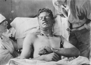 A victim of the mustard gas.